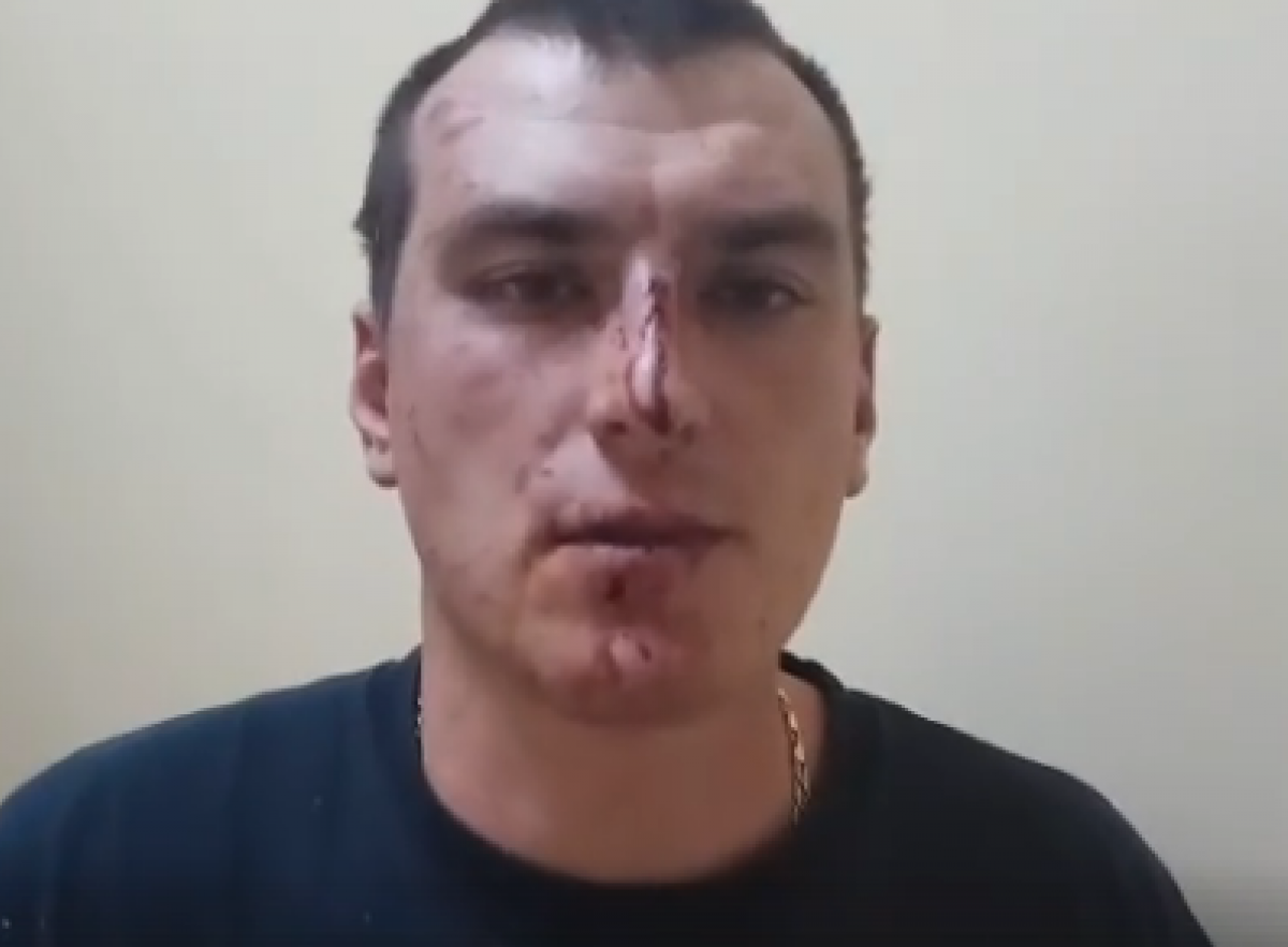 В Доброполье избили блогера