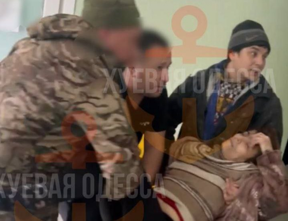 В Одесі багато поранених після ракетного удару. Фото місцевого телеграм-каналу