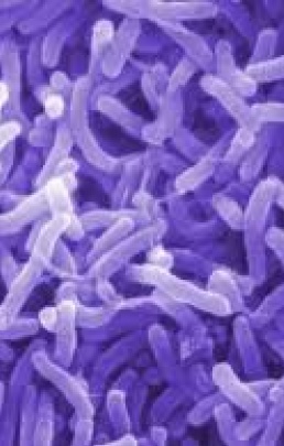 В Мариуполе подозревают новый случай холеры