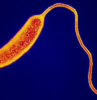 В Мариуполе подтвердился 20-й случай холеры