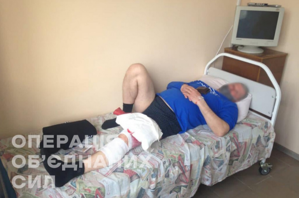В Донецкой области при обстреле ранен мирный житель. Подробности