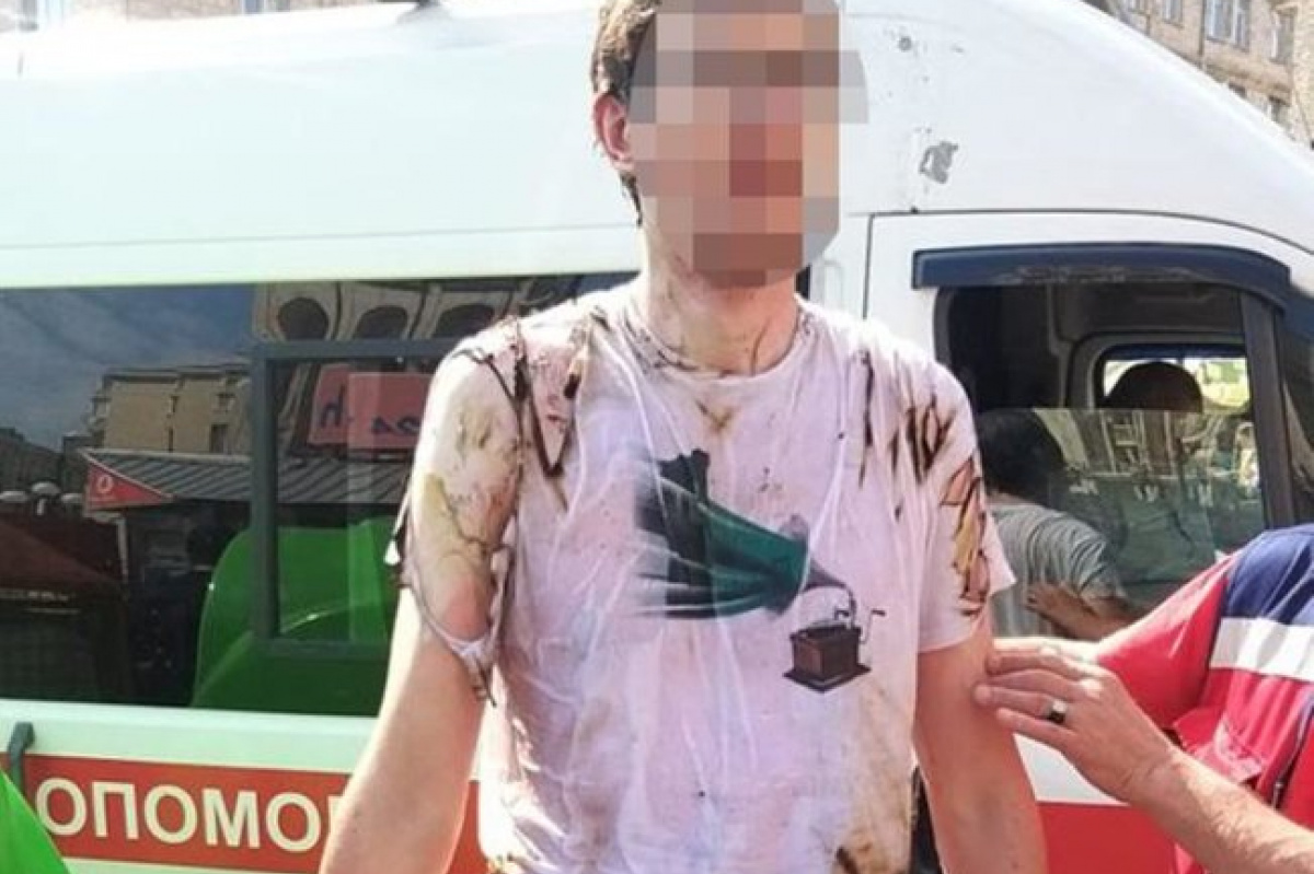 В центре Киева мужчина пытался себя поджечь – ему оказали помощь