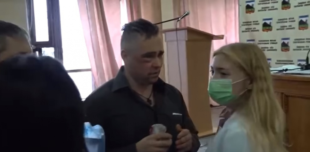 Пострадавший в драке депутат Артур Суков. Фото: скриншот видео Facebook
