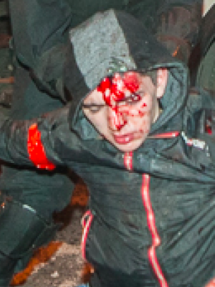 Фоторепортаж из кровавого центра Донецка: как убивали Дмитрия