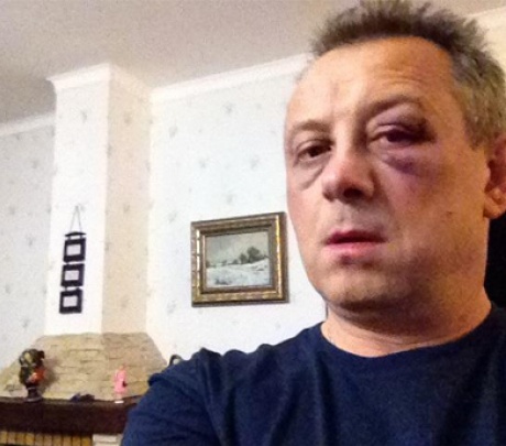 В Киеве избили депутата от партии УДАР