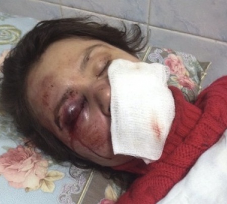 Журналистку Татьяну Чорновил жестоко избили под Киевом