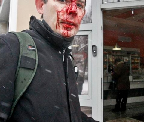Как в Донецке до крови избили журналистов